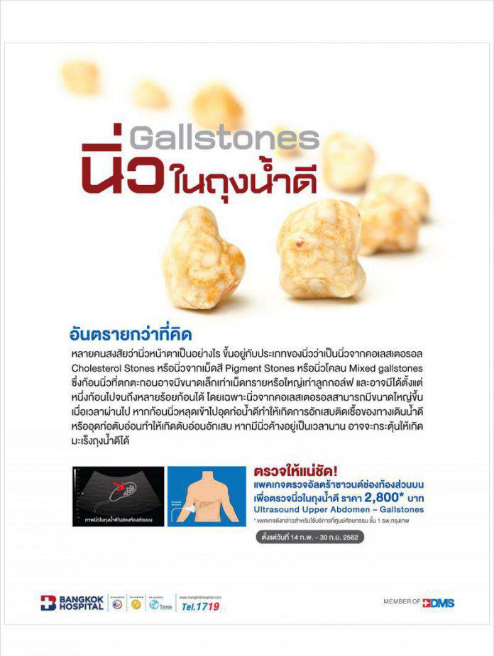 นิ่วในถุงน้ำดี_2019-Poster_02