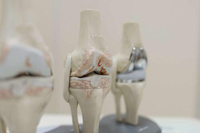 hip&knee_08